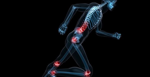 a skeleton with red highlights on the joints symbolizing pain