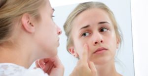 a young woman views her acne in a mirror